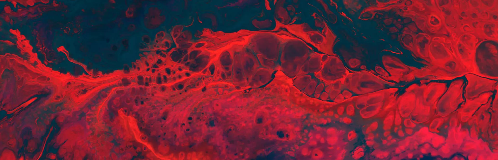 Imagen digital de un tumor neuroendocrino en infrarrojos